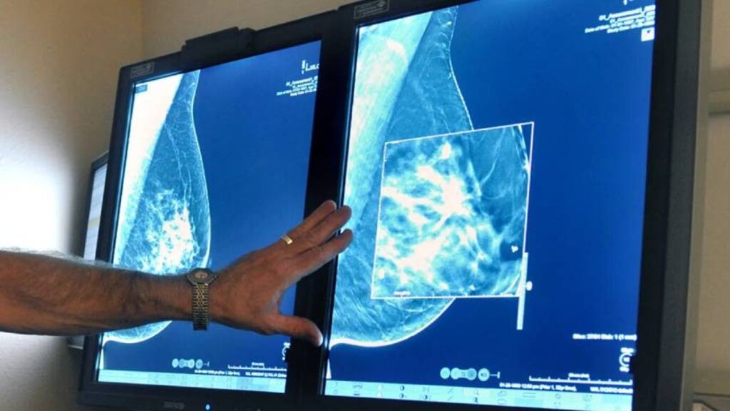 Breast cancer affects one in eight Bulgarian women 