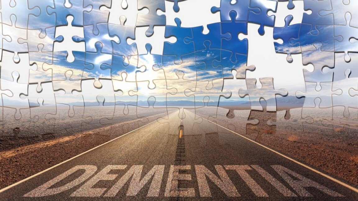 Д-р Иво Попиванов: При деменцията има спад, който се отклонява от нормалното стареене