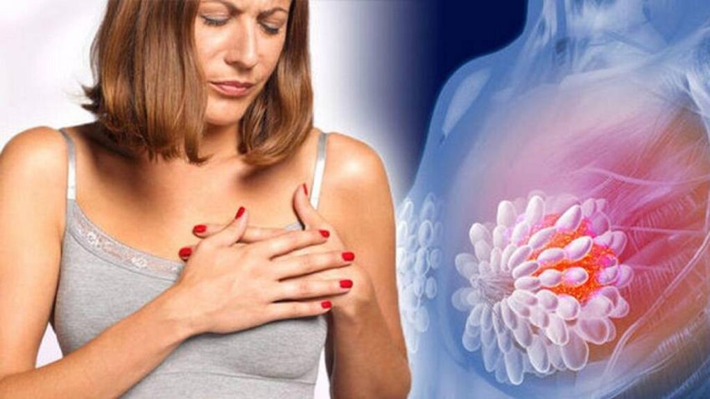 Breast cancer affects one in eight Bulgarian women 