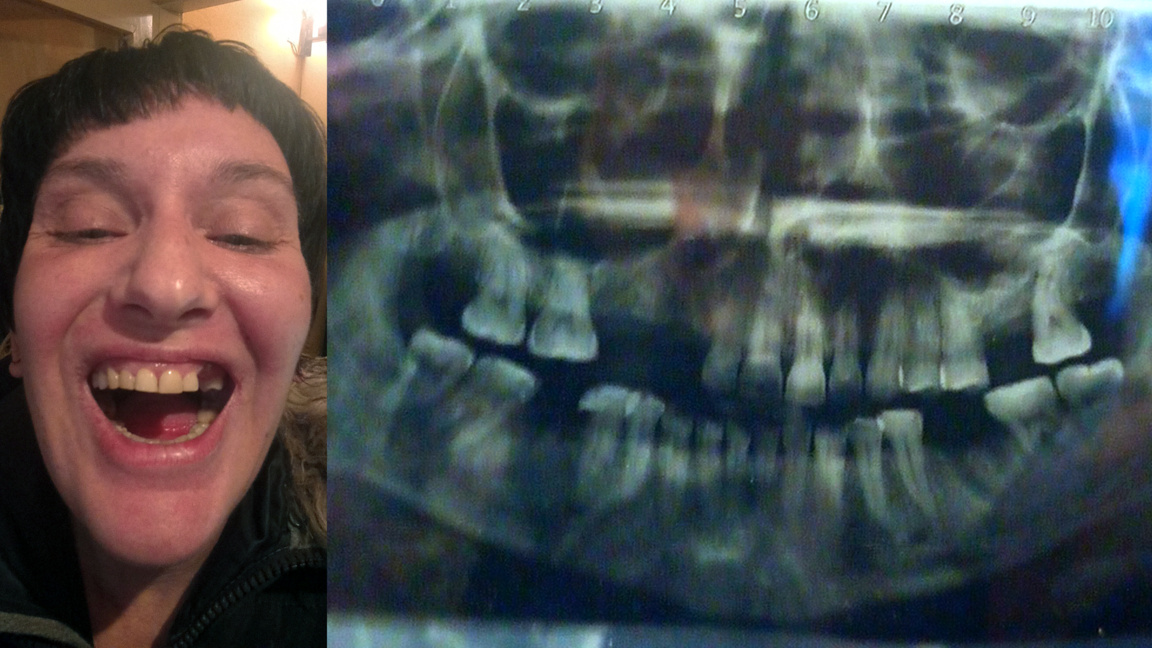 Зов за помощ: 43-годишната Милена се нуж...