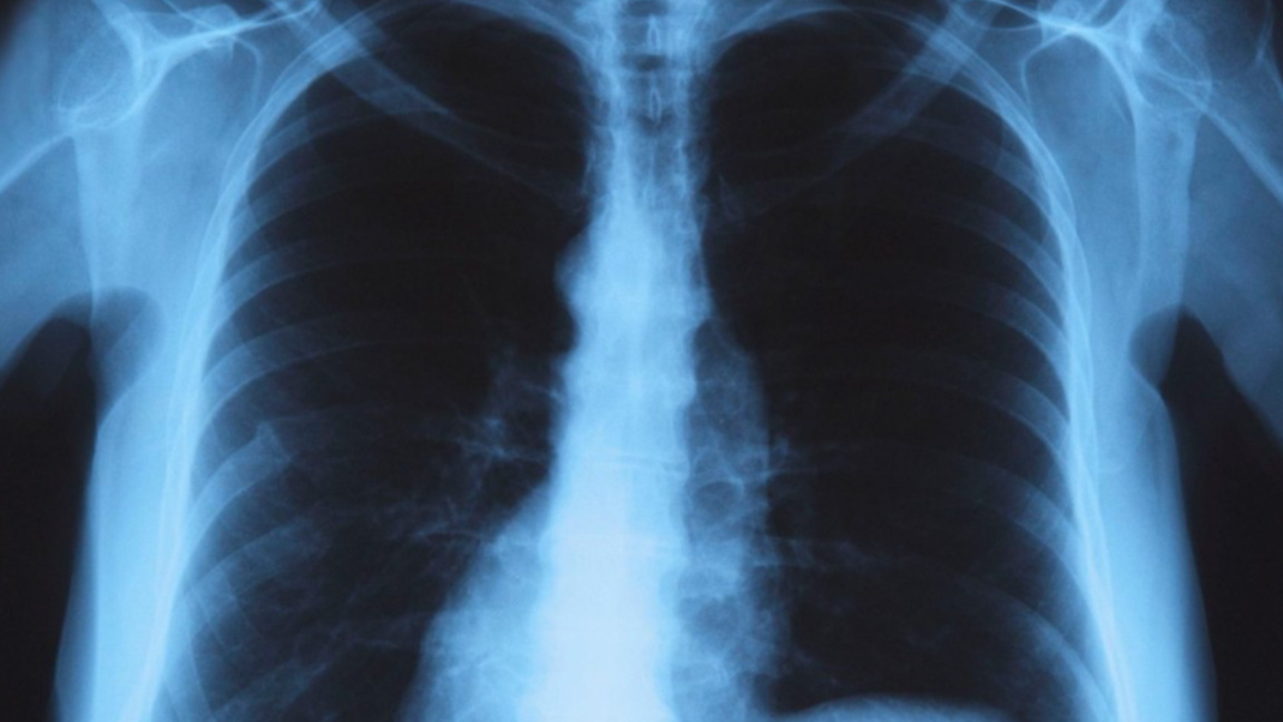 Снимката е илюстративна